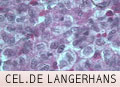 Células de Langerhans